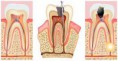 /album/fotogaleria-endodoncia/imagesnc4jdhqt-jpg/